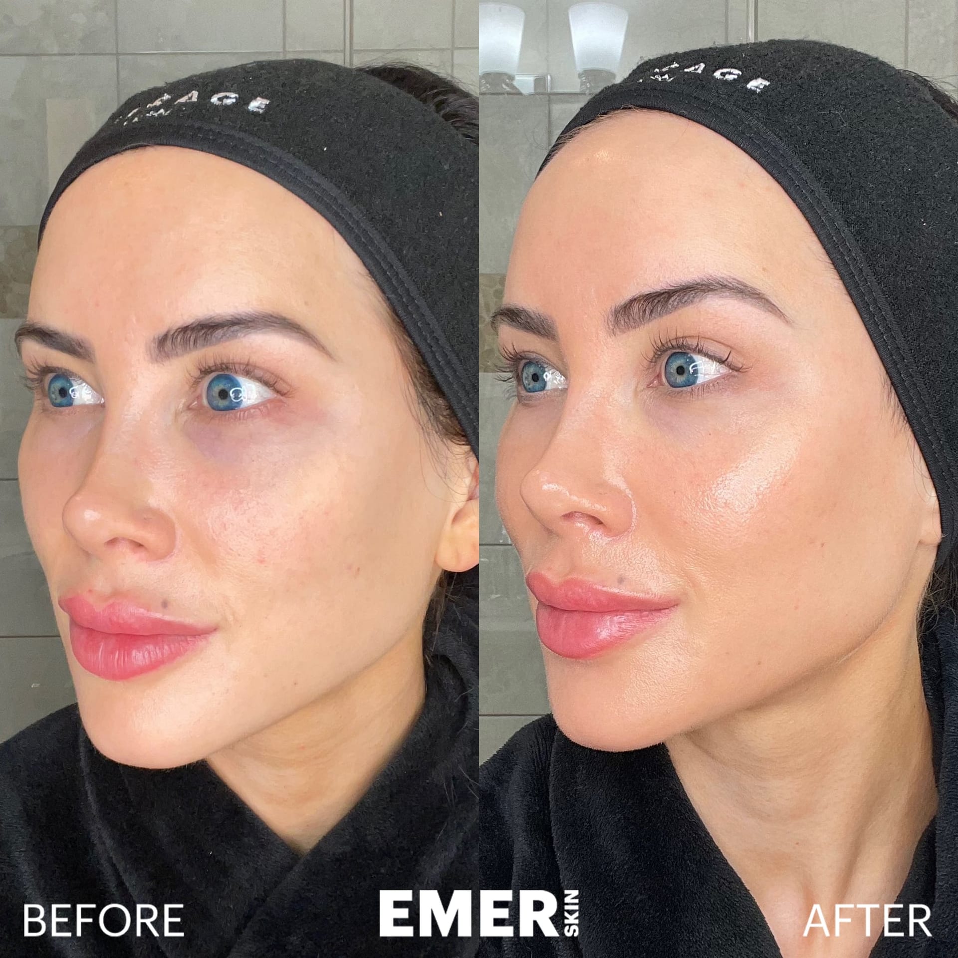 Average Baseline — CELESTA