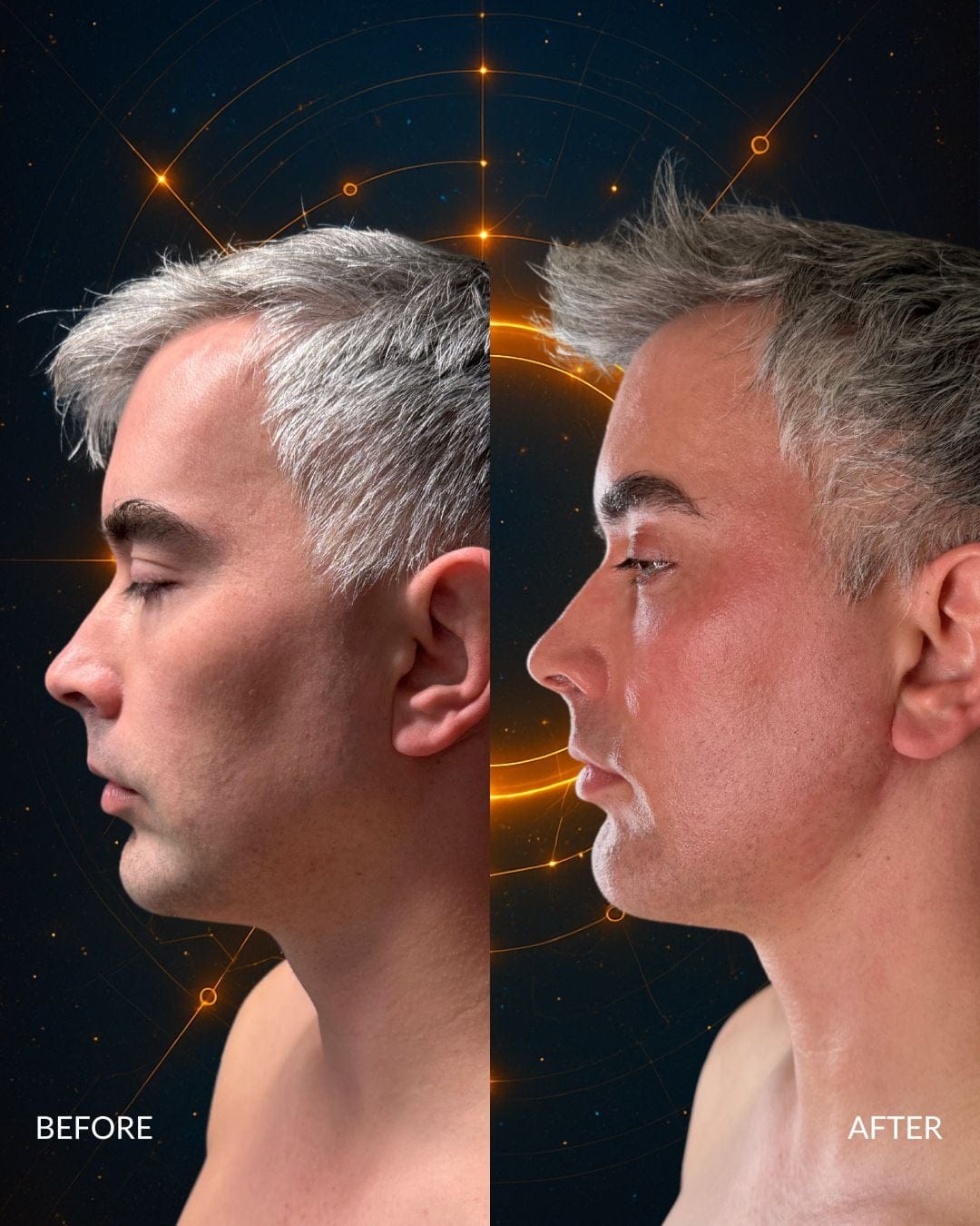 Male Facial Sculpting Before and After